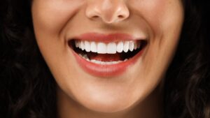 The Importance of Regular Dental Checkups